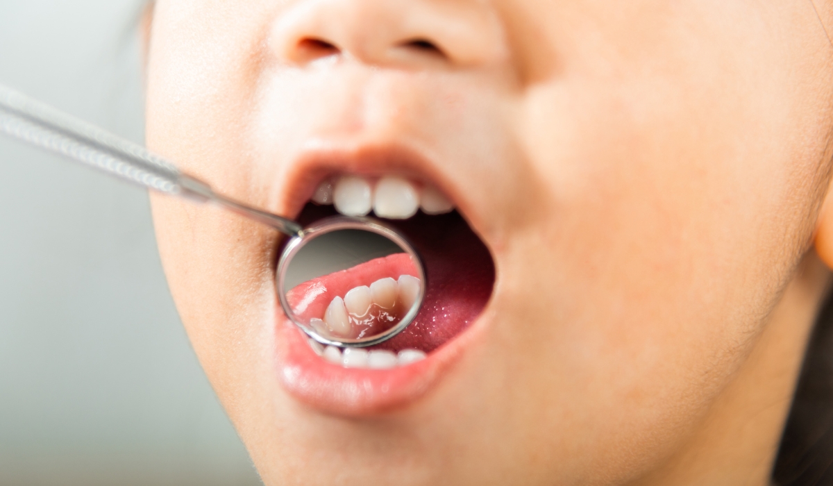 MoPH Launches 3rd National Oral and Dental Health Survey